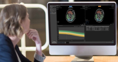 Quantib’s Quest: Startup Assists Radiologists in Detecting Dementia