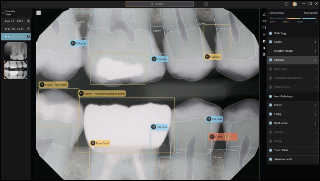 Tooth Tech: AI Takes Bite Out of Dental Slide Misses by Assisting Doctors